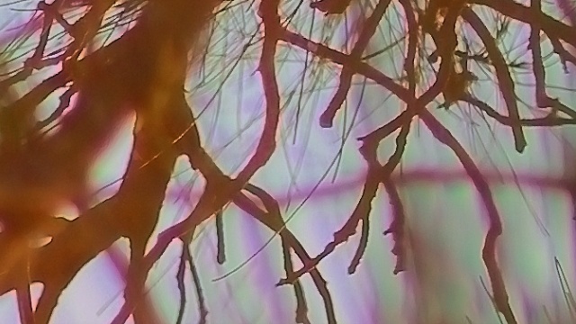 Chromatic aberrations/purple fringing